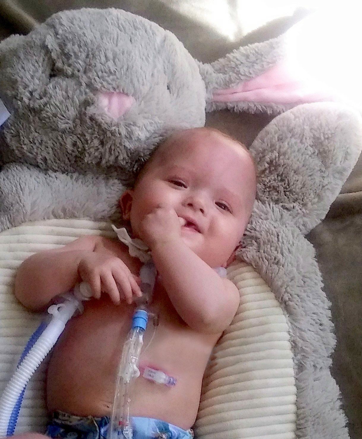 Serafina, infant with heart birth defects.