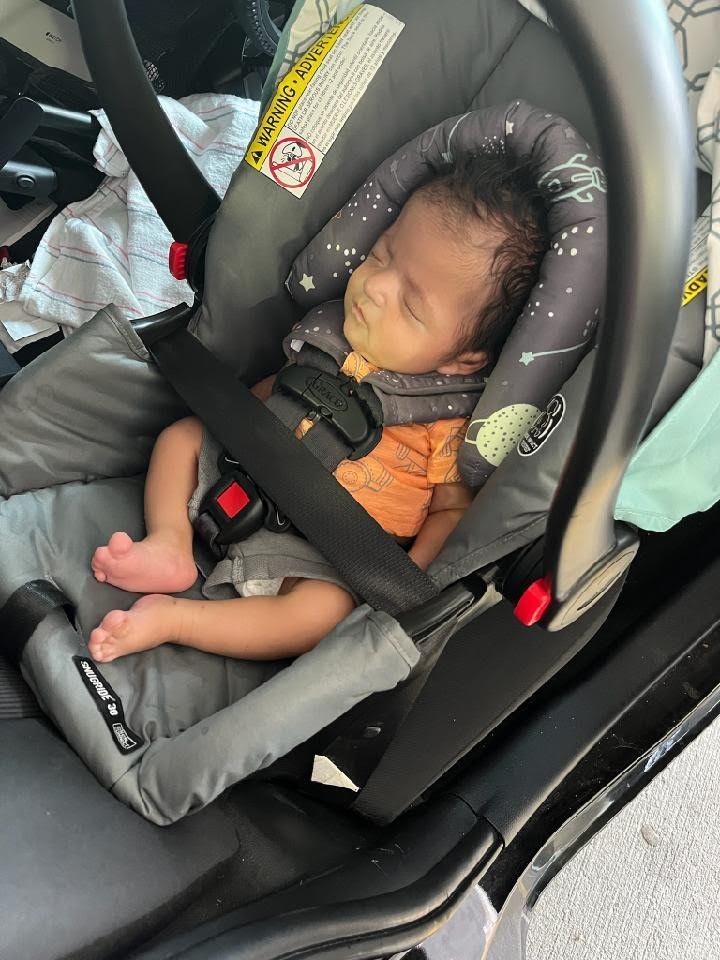 Jonathan, baby with genetic defects.