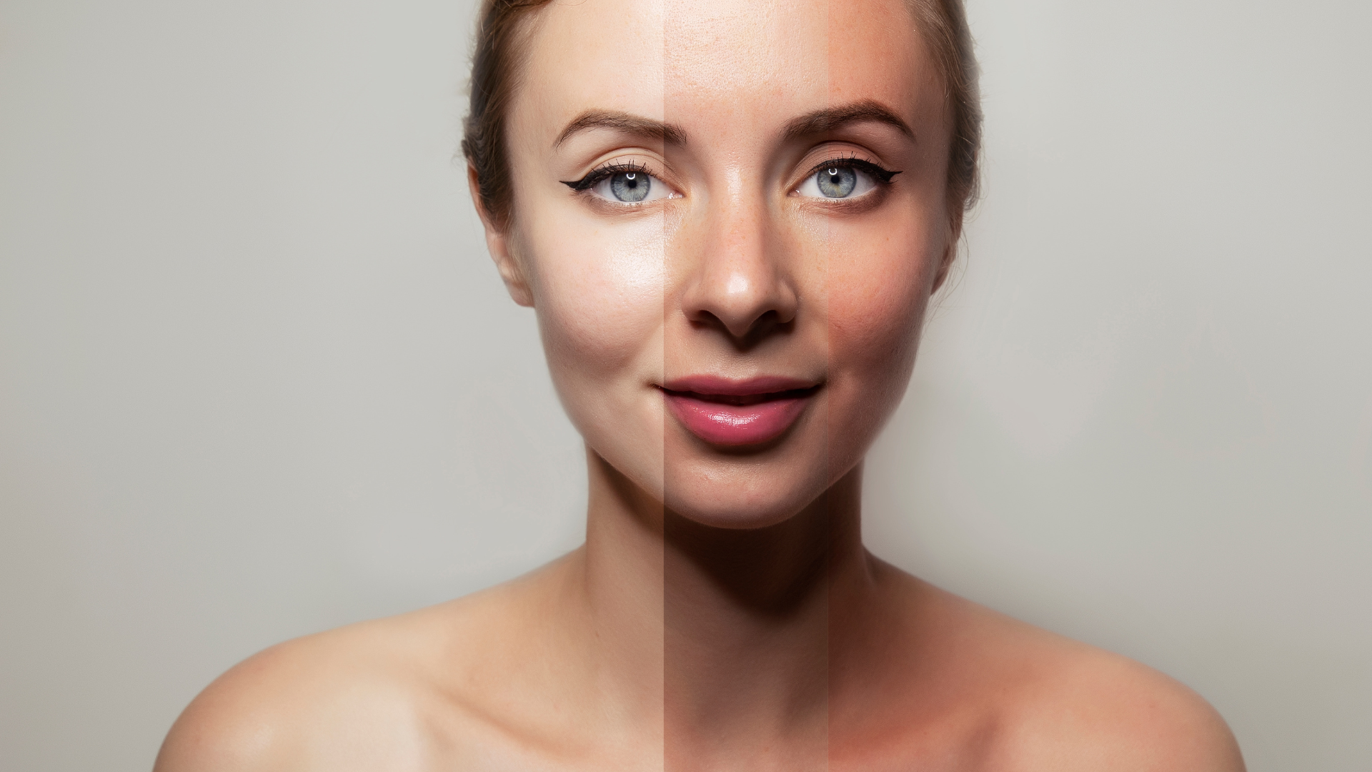 A woman 's face is shown before and after being sunburned.