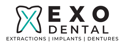 Exo Dental: Extractions Implants Dentures