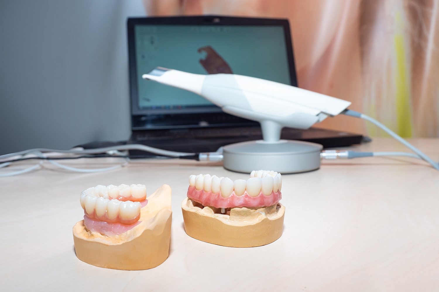 digital dentures using a digital scanner to scan in a model of teeth on the computer