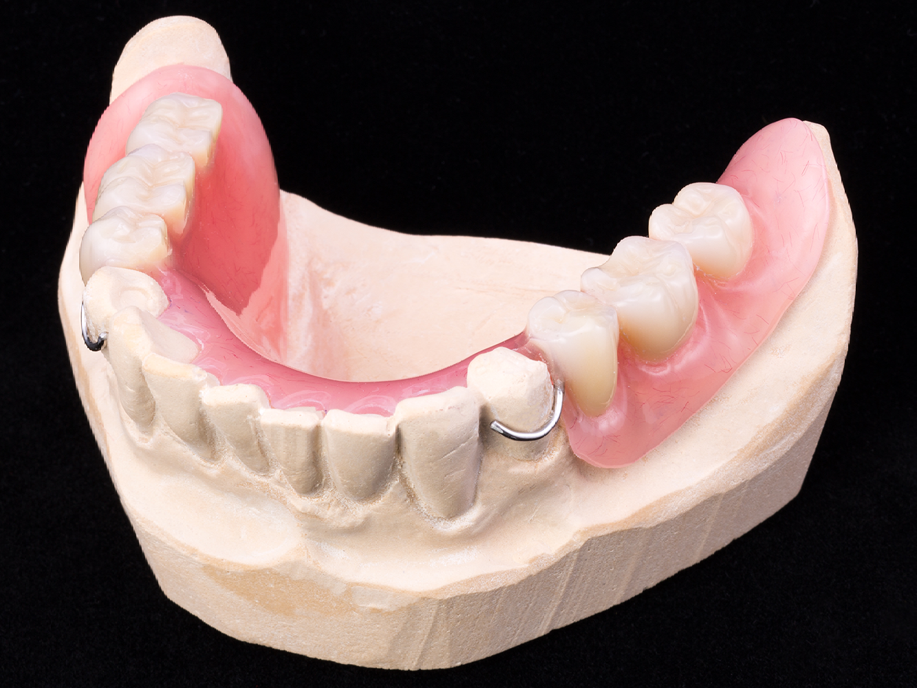 model of acrylic and temporary partials fitted to the model teeth