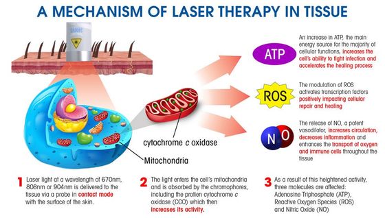 How laser therapy works on the body