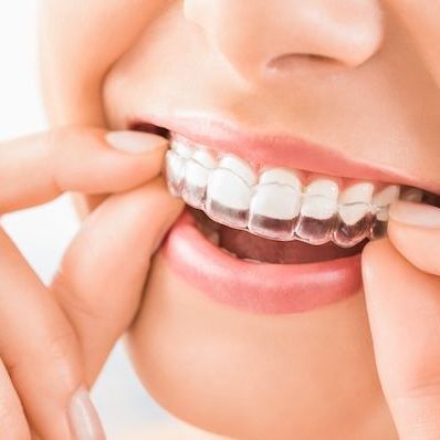 Invisalign
