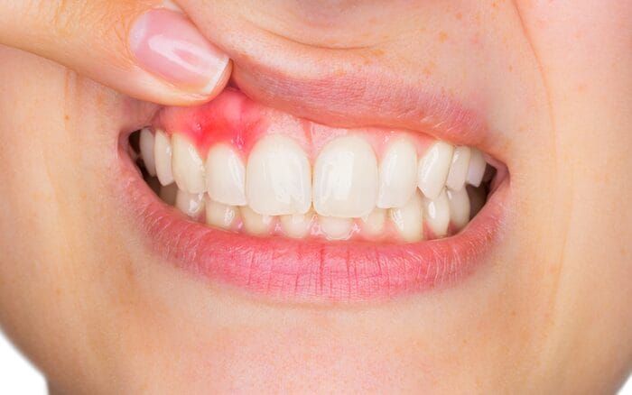 Man smiling