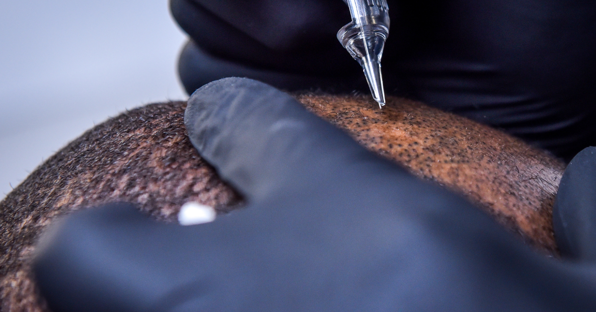 Close-up of gloved hands using a tattoo gun on dark skin.