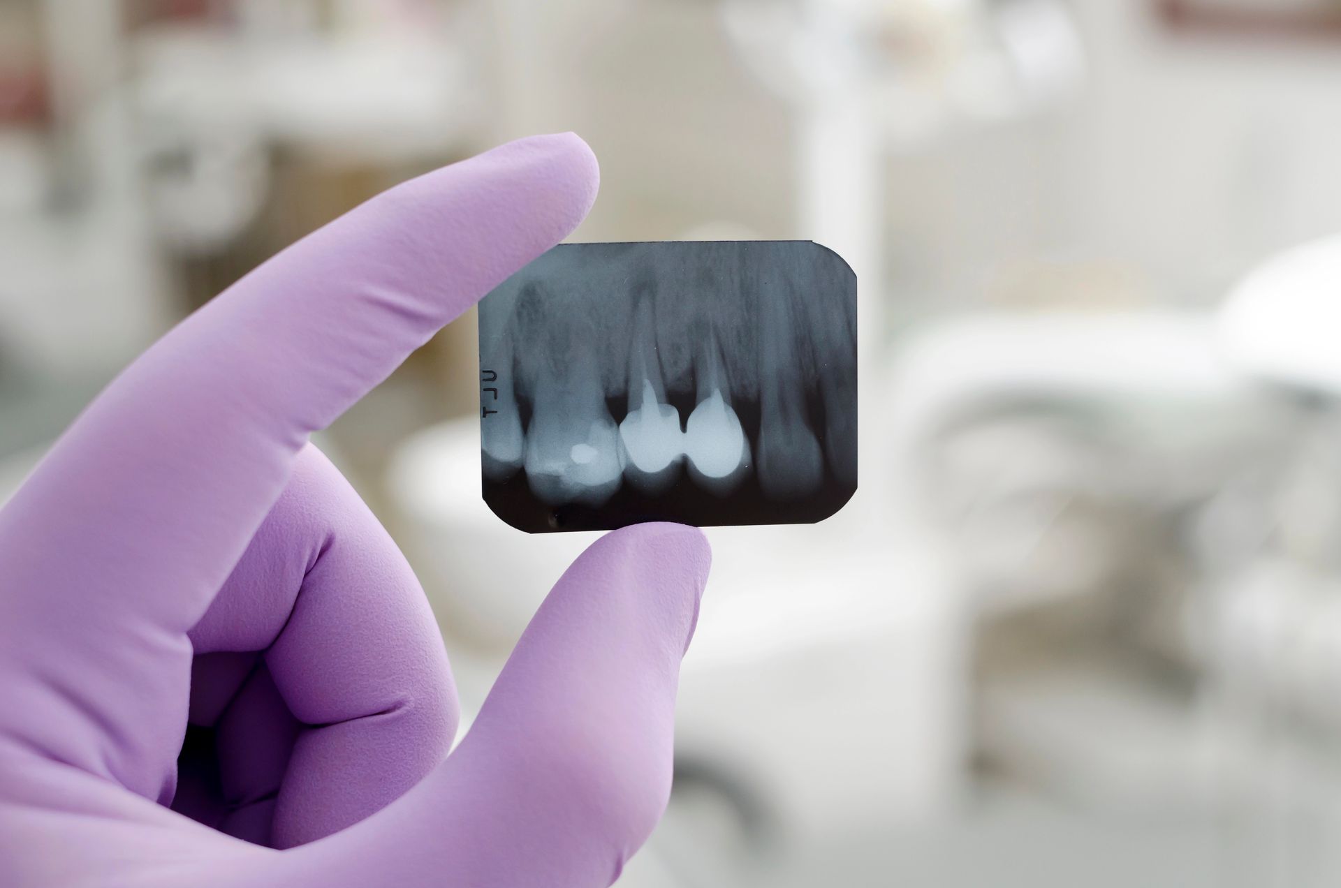 Un dentista sostiene una radiografía de los dientes de una persona.