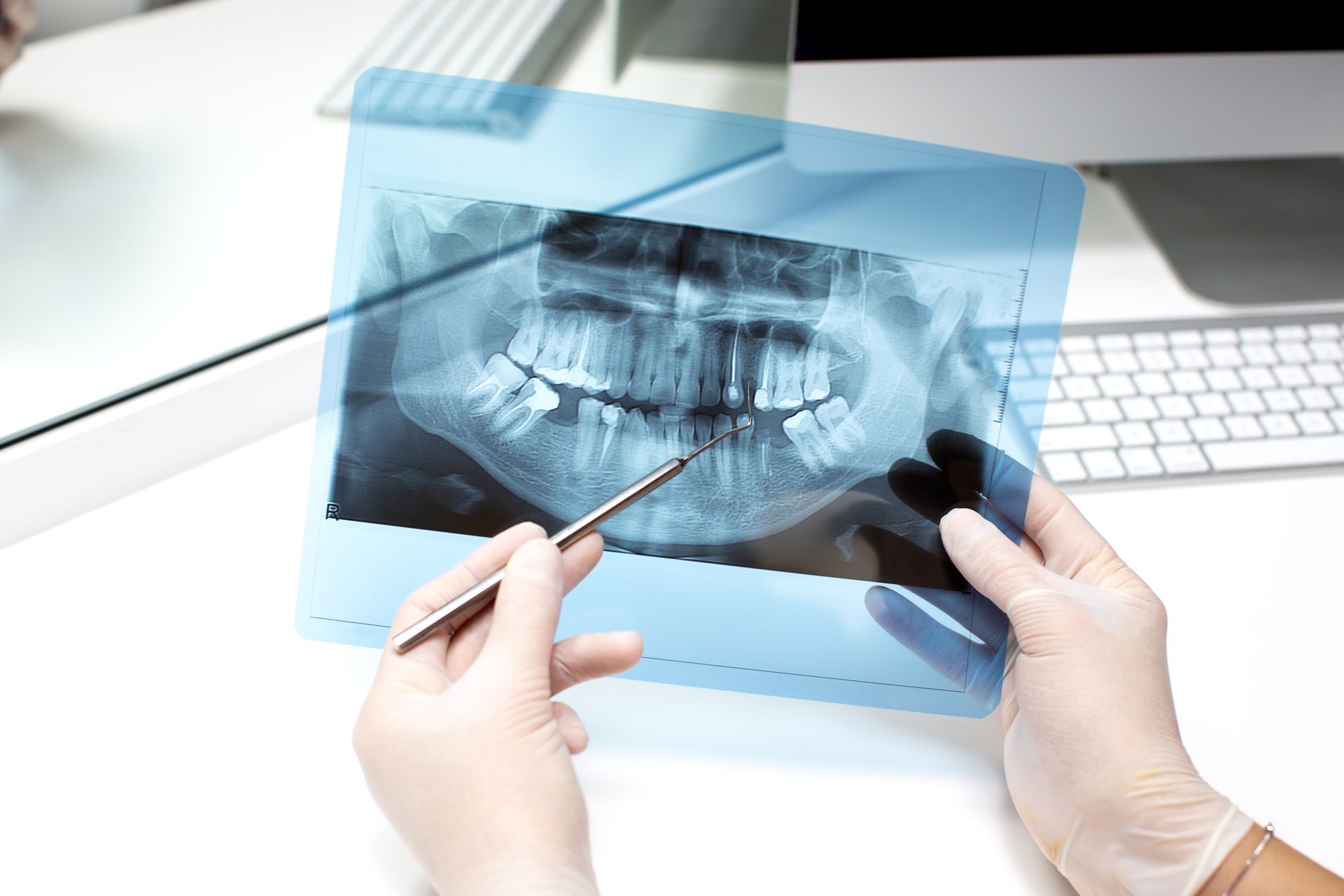 Un dentista está mirando una radiografía de los dientes de una persona.