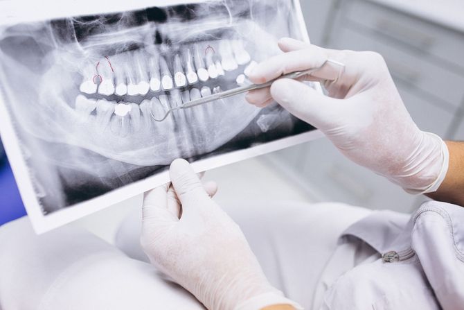 Un dentista está mirando una radiografía de los dientes de un paciente.