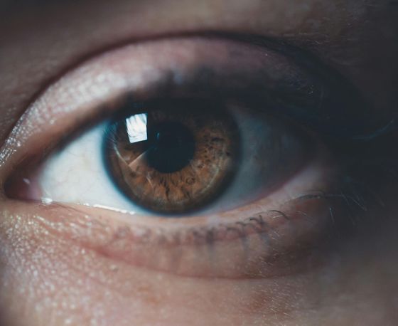 A close up of a person 's brown eye with a white pupil.