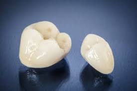 CEREC® Crowns on a table | Same Day Crowns Dentist Marshfield MO