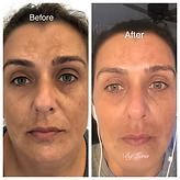 Side-by-side face comparison labeled 