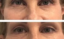 Close-up of eyes before and after makeup, showing a more defined eyebrow and brighter look.