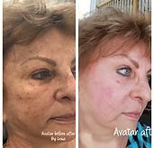 Side-by-side profile portrait showing before-and-after skin appearance and makeup.