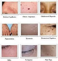 Grid of nine close-up skin condition photos with labels, showing blemishes, redness, scales, and dark spots