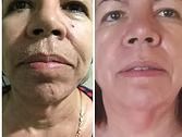 Side-by-side close-up face comparison, one with darker skin and one with lighter skin, both neutral expression