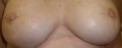 Close-up of a person’s bare chest with large breasts and visible nipples