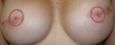Close-up of bare breasts with red circles marking each nipple.