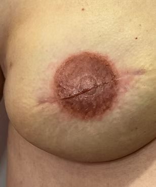 Close-up of a human nipple and areola with a darker circular patch around it