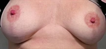 Close-up of an adult torso showing exposed breasts against a plain background