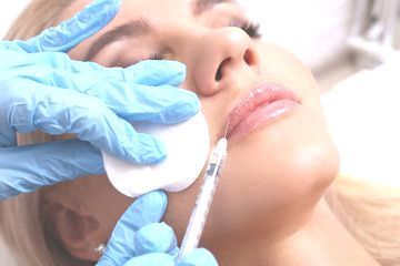 Dermal Fillers Juvederm