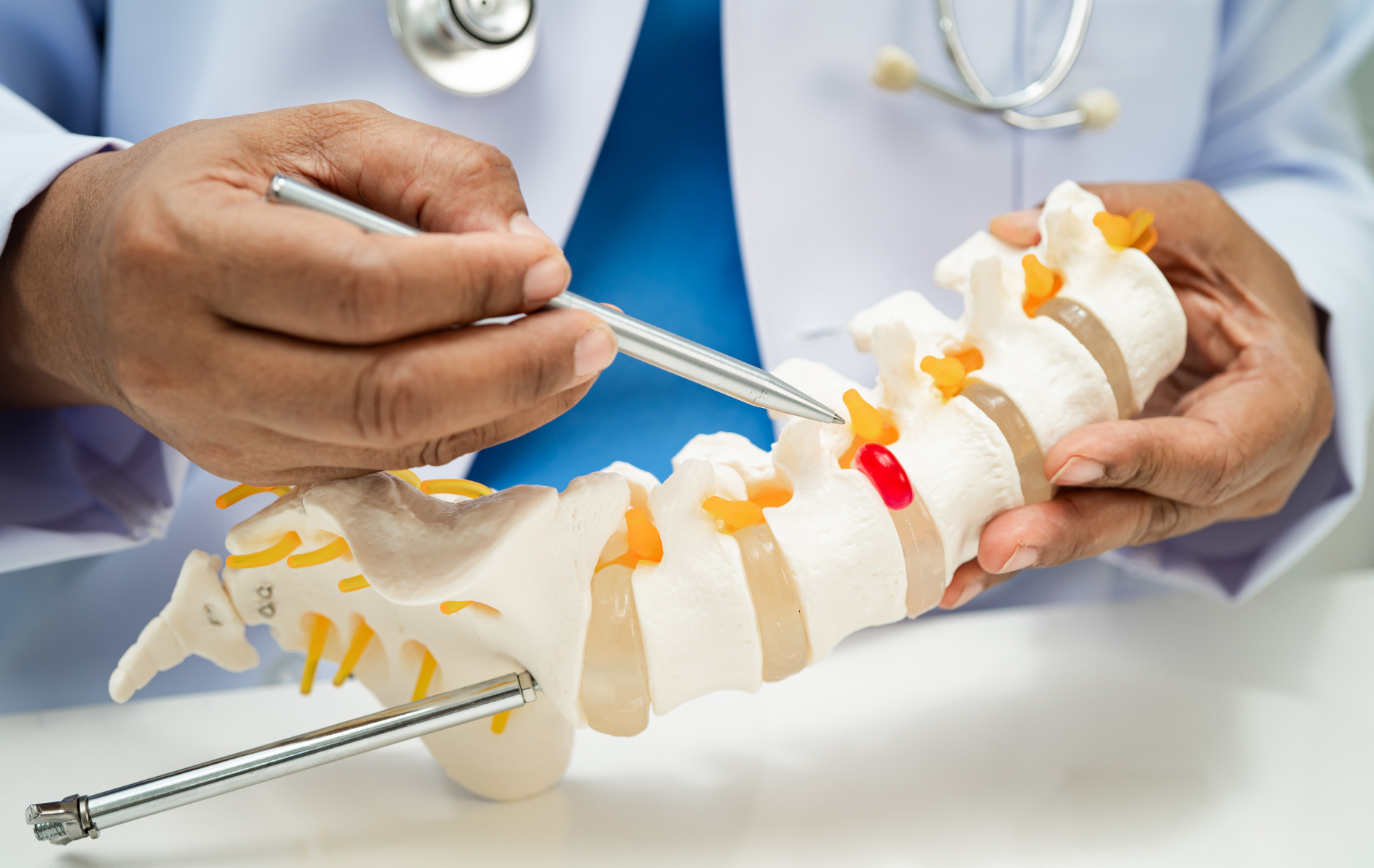 Doctor pointing to a spinal model, highlighting a red area.