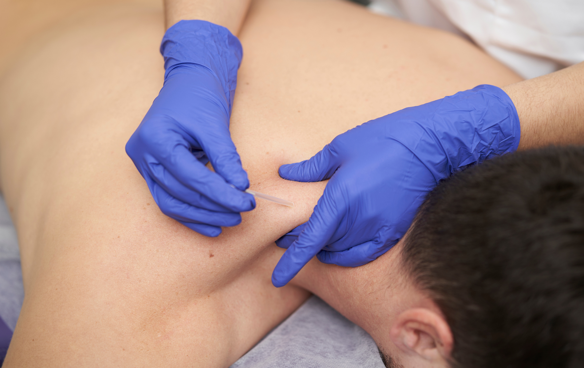 Person receiving back massage; gloved hands knead shoulder. Blue gloves, white surface.