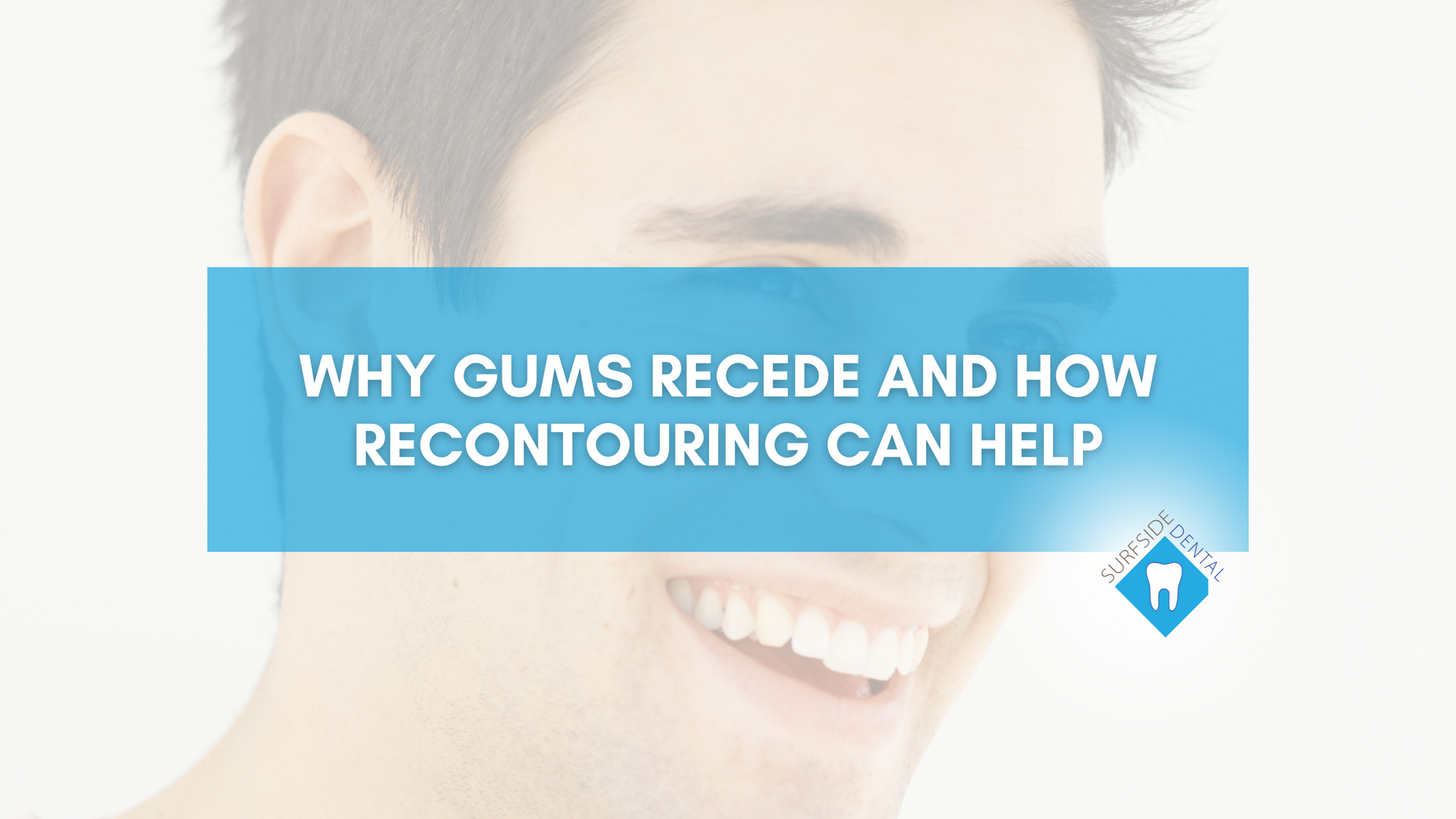 A man is smiling with a blue banner that says why gums recede and how recontouring can help.