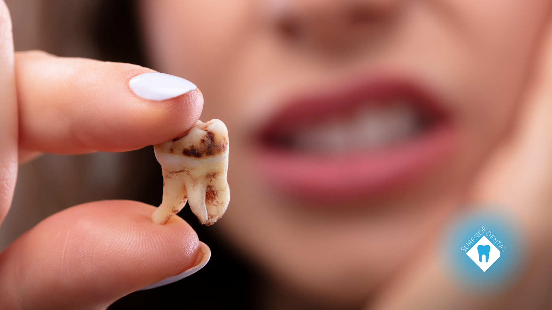 A woman is holding a tooth in her hand in front of her mouth.