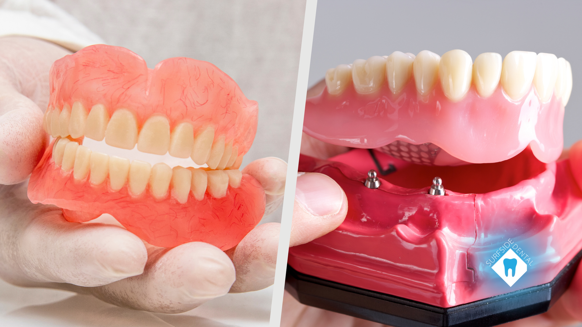 A person is holding a denture and a model of a denture.