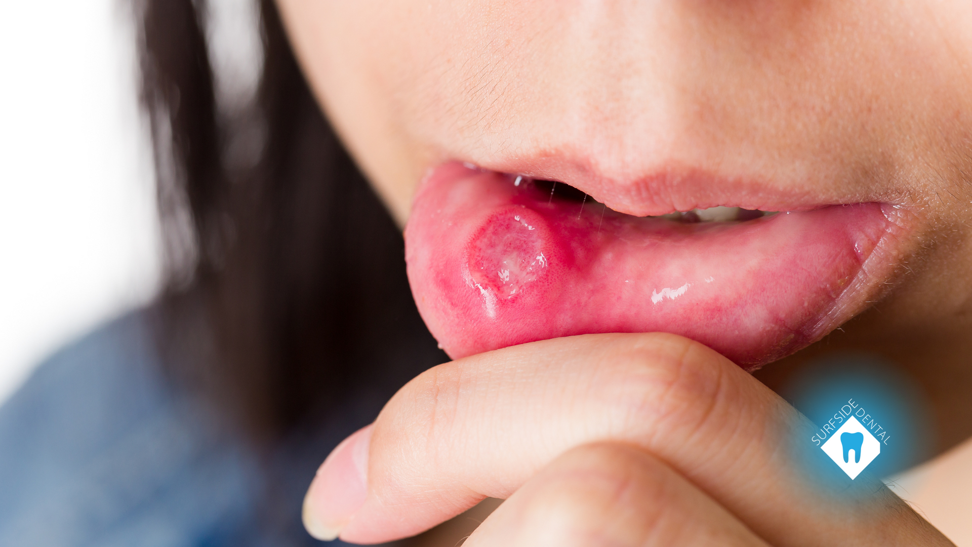 A close up of a person 's mouth with a toothache.