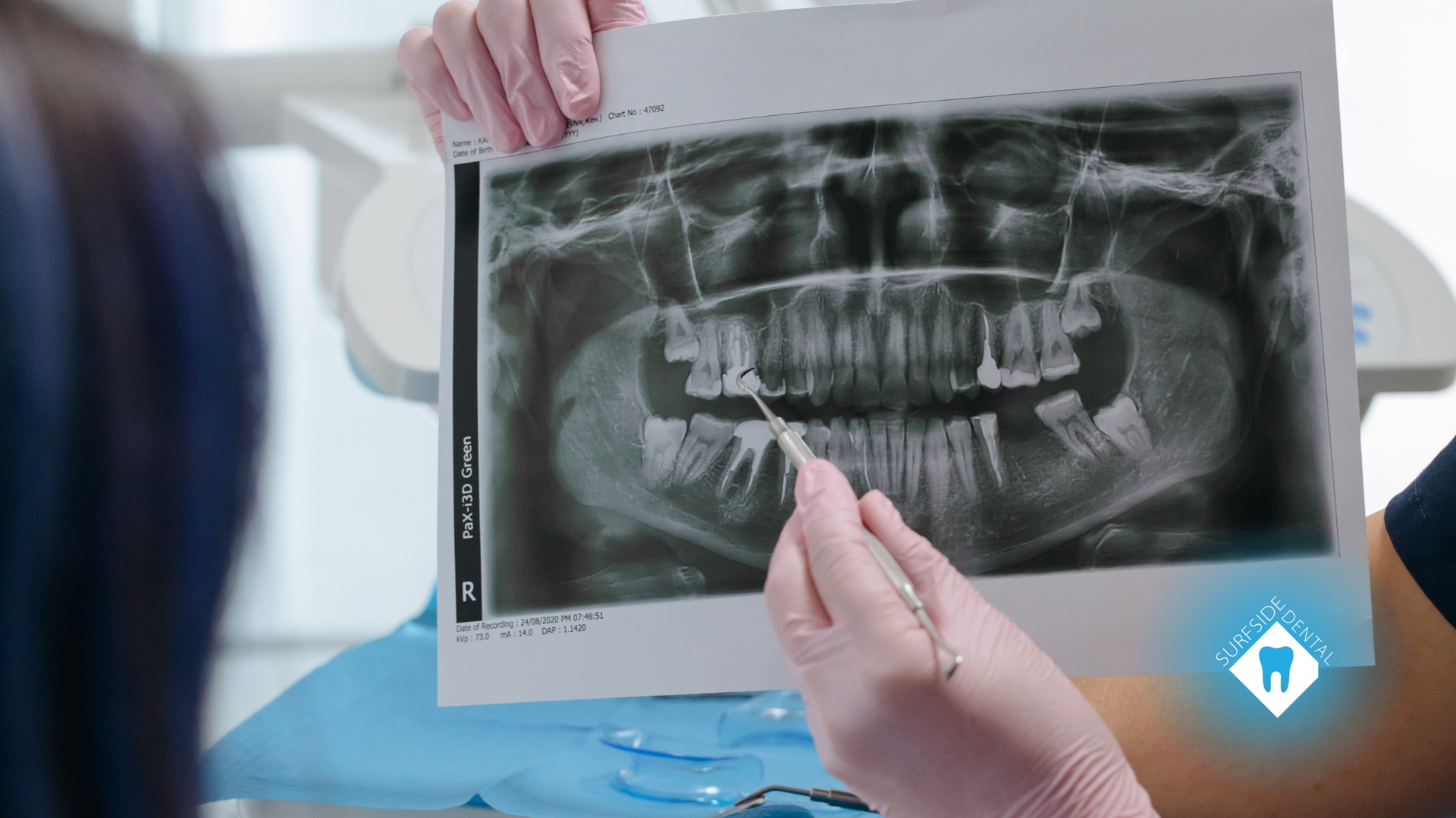 A dentist is holding an x-ray of a patient 's teeth.