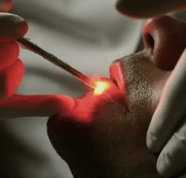 Laserterapia