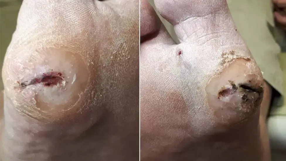 Toetal footcare Podiatrists, Cardiff & Pontypridd