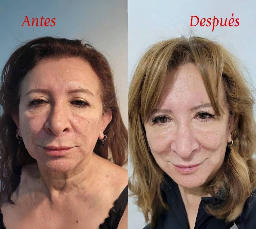Antes y después de una mujer: retrato comparativo con cambio de peinado y maquillaje.