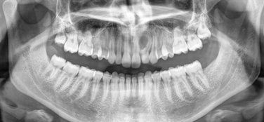 Radiologie Dentaire CIN Paris Daumesnil