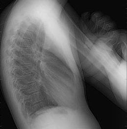 Radiologie Ostéo-articulaire CIN Paris Daumesnil