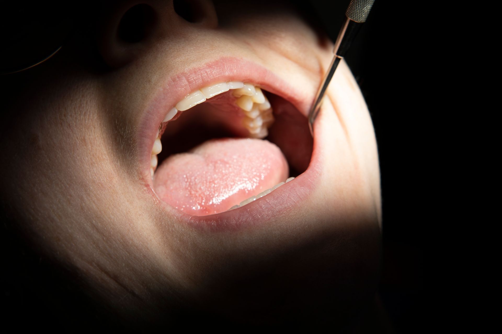 apparecchio con tecnologia CAD/CAM