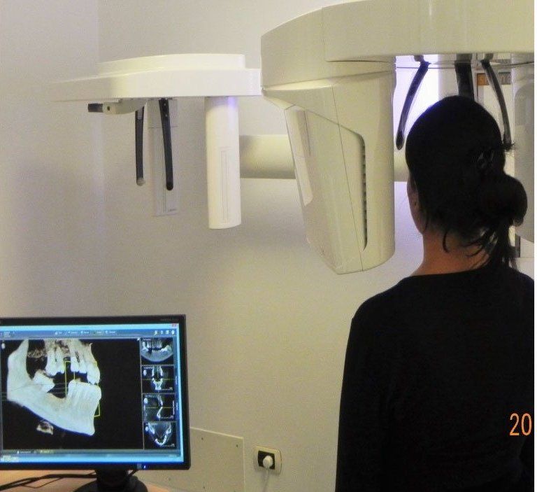 radiografia dentale