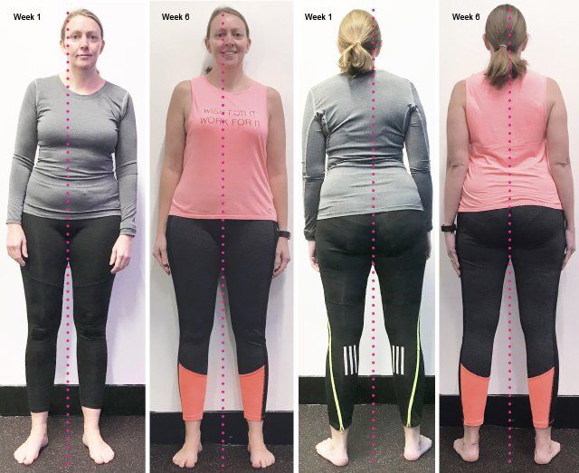 Posture Improvement, increase mobility, somatic movement, ease pain
