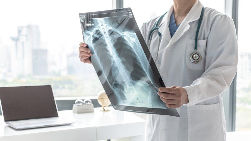 medico mentre controlla una radiografia
