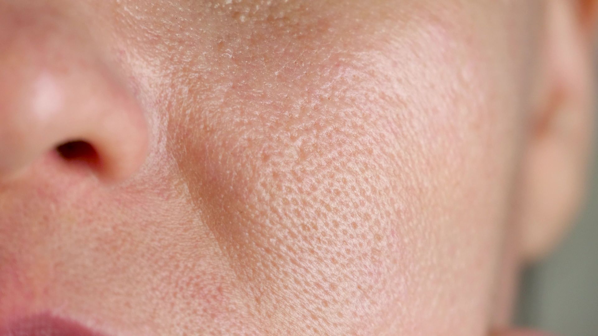 Close-up of a person’s cheek and nose with visible skin texture