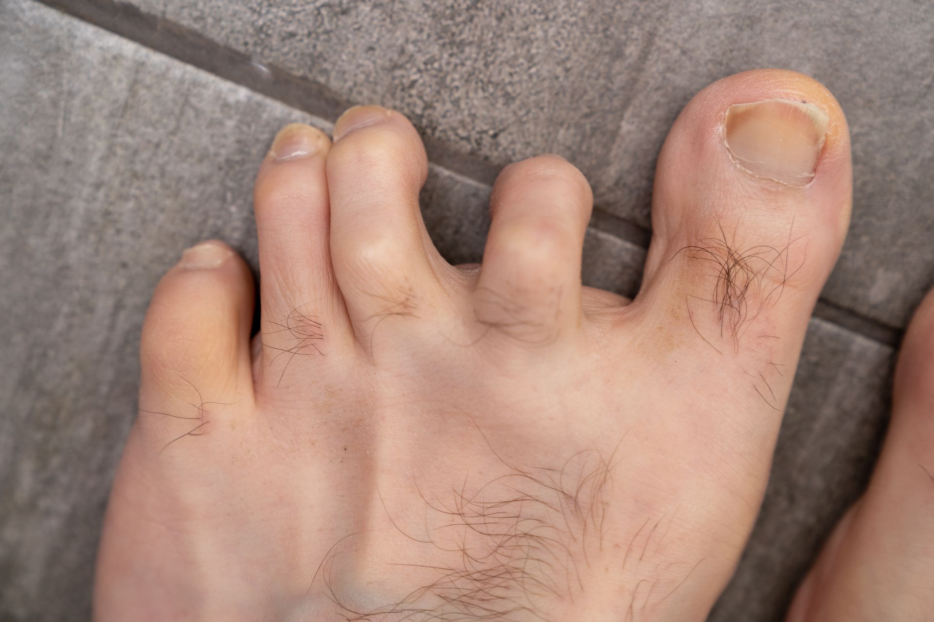 Close-up of a light-skinned foot with visible toes on a grey tile floor.