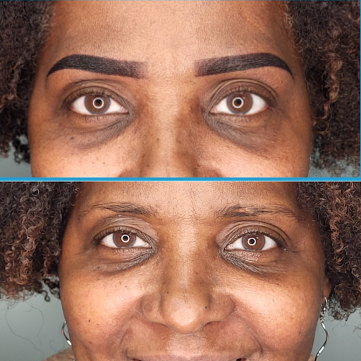 Before and after eyebrow transformation on a woman showing fuller, defined brows.