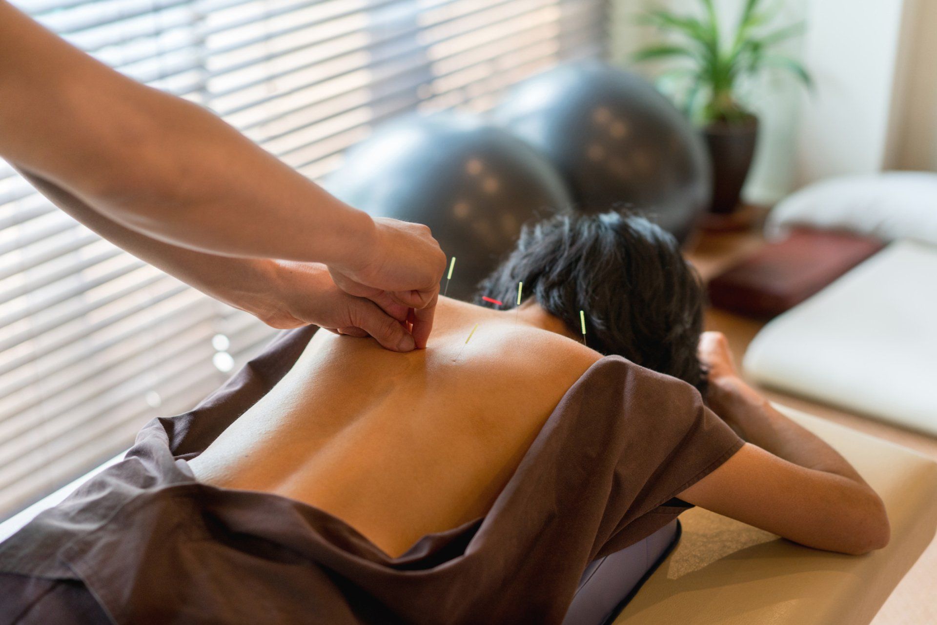 Acupuncture Treatment — Vancouver, WA — Vancouver Acupuncture