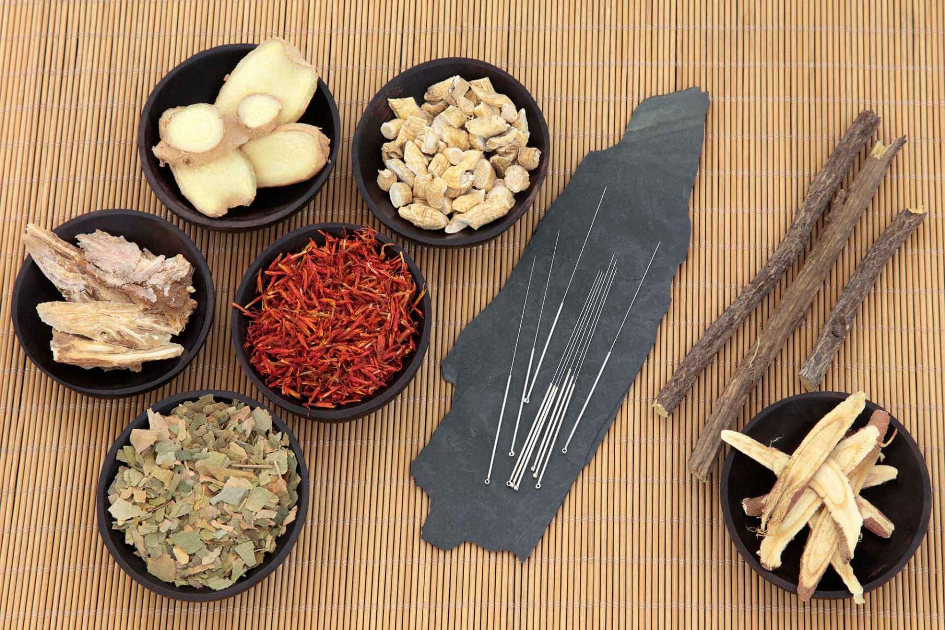 Acupuncture Needles with Chinese Herbal Medicine — Vancouver, WA — Vancouver Acupuncture
