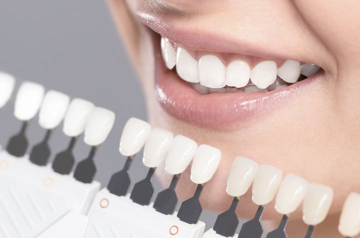 Cosmetic Dentistry — White Teeth in San Bernardino, CA