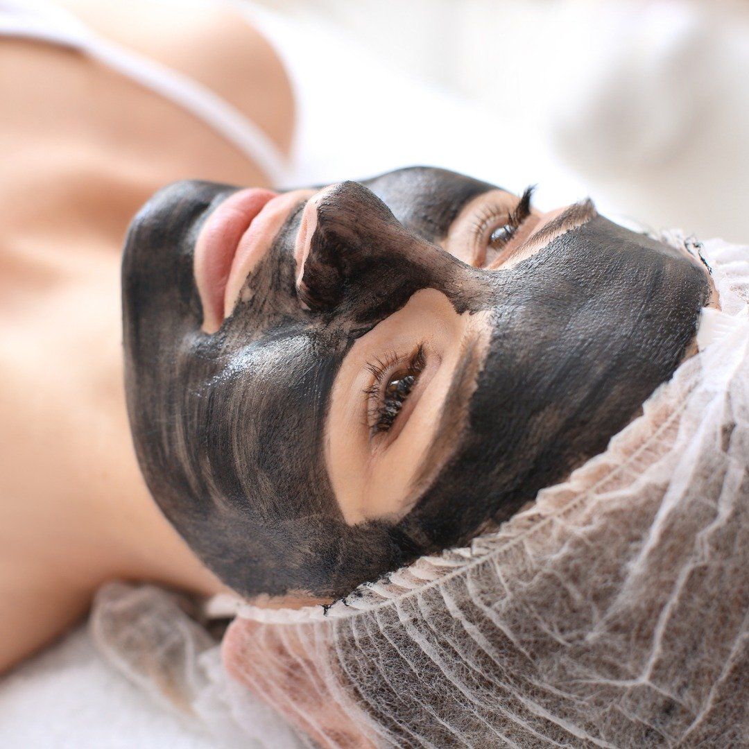 Carbon Peel — Beauty Clinic Bundaberg, QLD