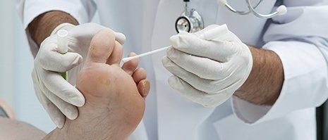 trattamento di una verruca