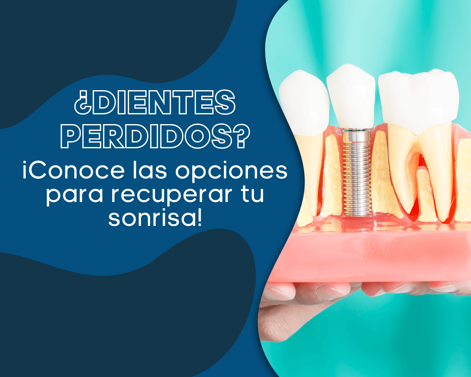 ▷ Limpieza Dental con Ultrasonidos 【Pros y Contras】